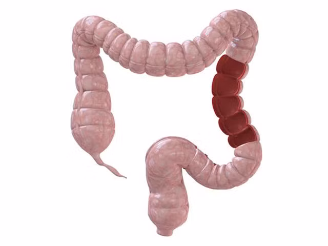 Tu phat hien benh duong ruot nho dau hieu “1 dau, 1 den, 3 mui”