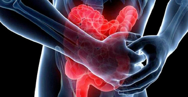 Tự phát hiện bệnh đường ruột nhờ dấu hiệu “1 đau, 1 đen, 3 mùi” - Hình 6 Tu phat hien benh duong ruot nho dau hieu “1 dau, 1 den, 3 mui”-Hinh-6