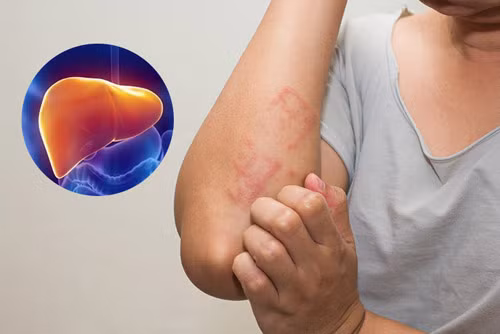 Loat thoi quen buoi sang hai gan nhieu nguoi bo qua-Hinh-12