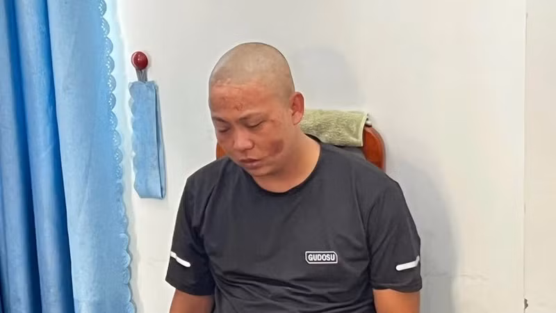 Bắt khẩn cấp đối tượng chém cán bộ Công an trọng thương