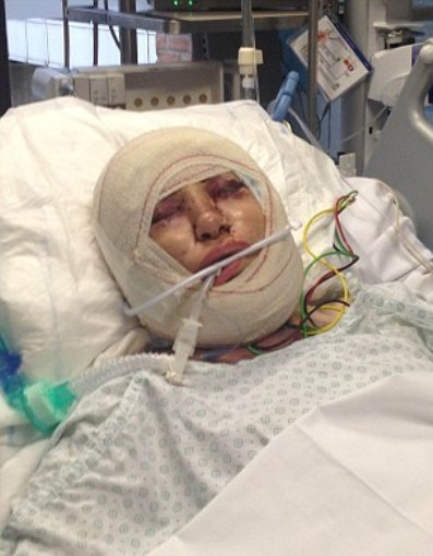 Trong quá trình phẫu thuật, cô đã bị chảy máu bên trong. Các bác sĩ cho rằng nguyên nhân chính là do bà có tiền sử đau tim và Asprin đã làm cho máu không thể đông.