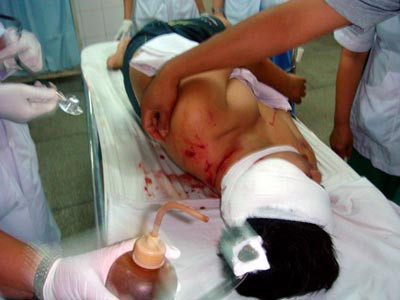  4. Hổ sổng chuồng cắn chết nhân viên ở khu du lịch Đại Nam Chiều 10/9/2009, ba nhân viên vườn thú khu du lịch Đại Nam, tỉnh Bình Dương đang trồng cây xanh bất ngờ bị một con hổ chuồng kế bên nhảy qua vách ngăn cao 3m tấn công. Một người bị hổ cắn chết tại chỗ. Theo nhận định của ban quản lý vườn thú, nhiều khả năng các con hổ đã bị hoảng sợ khi nhân viên vườn thú dùng cần cẩu để trồng cây xanh.