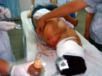  4. Hổ sổng chuồng cắn chết nhân viên ở khu du lịch Đại Nam Chiều 10/9/2009, ba nhân viên vườn thú khu du lịch Đại Nam, tỉnh Bình Dương đang trồng cây xanh bất ngờ bị một con hổ chuồng kế bên nhảy qua vách ngăn cao 3m tấn công. Một người bị hổ cắn chết tại chỗ. Theo nhận định của ban quản lý vườn thú, nhiều khả năng các con hổ đã bị hoảng sợ khi nhân viên vườn thú dùng cần cẩu để trồng cây xanh.