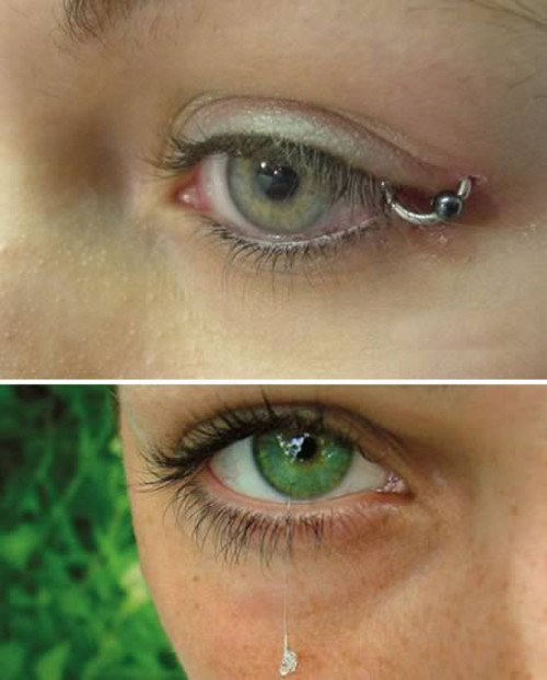 Đeo khuyên ở mắt. Ai cũng thấy ghê người khi nhìn thấy đôi mắt được đeo khuyên xuyên qua nhãn cầu và mí mắt này.