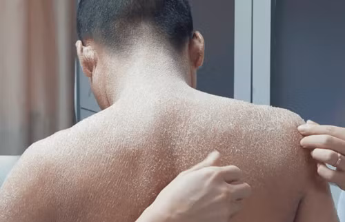Cha mẹ kết hôn cận huyết khiến con trai bị khiếm khuyết di truyền đáng sợ Cha me ket hon can huyet khien con trai bi khiem khuyet di truyen dang so