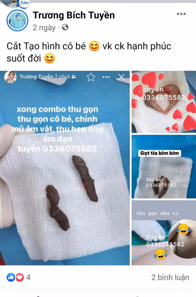 TMV Hoa Sen quảng cáo lố: Thực hiện quy trình hút mỡ như “lò mổ“? - Hình 4 TMV Hoa Sen quang cao lo: Thuc hien quy trinh hut mo nhu “lo mo“?-Hinh-4