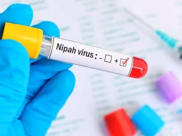 Virus Nipah bùng phát, tỷ lệ tử vong tới 75% Virus Nipah bung phat, ty le tu vong toi 75%
