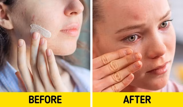 7 sản phẩm làm đẹp có thể hủy hoại làn da - Hình 2 7 san pham lam dep co the huy hoai lan da-Hinh-2