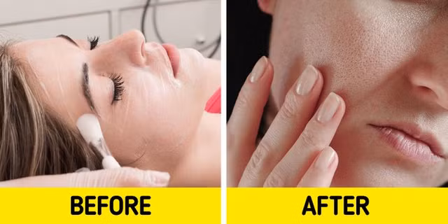 7 sản phẩm làm đẹp có thể hủy hoại làn da - Hình 6 7 san pham lam dep co the huy hoai lan da-Hinh-6