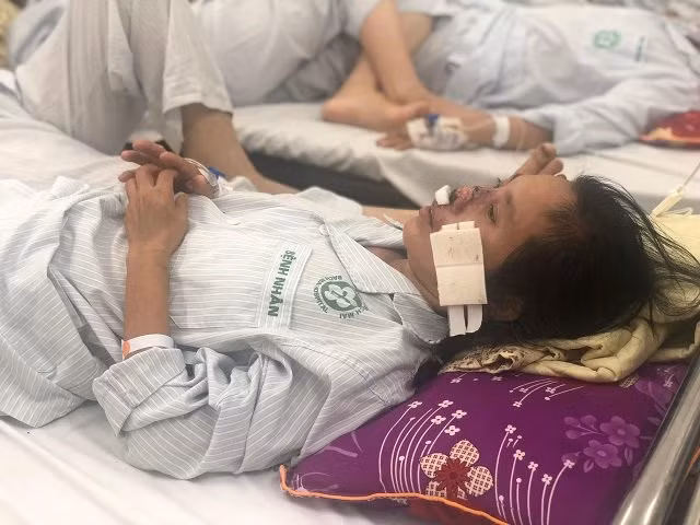 Vi khuẩn 'ăn mũi người' đang hoành hành và những sự thật kinh hoàng - Hình 2 Vi khuan 'an mui nguoi' dang hoanh hanh va nhung su that kinh hoang-Hinh-2