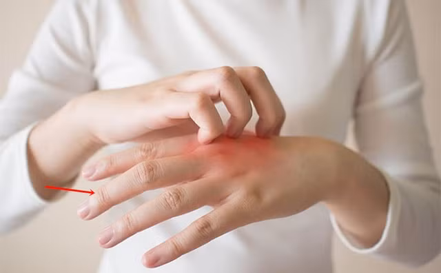 Kiểm tra sức khoẻ của gan qua ngón tay giữa như nào? - Hình 5 Kiem tra suc khoe cua gan qua ngon tay giua nhu nao?-Hinh-5