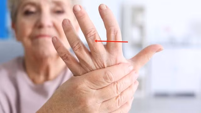Kiểm tra sức khoẻ của gan qua ngón tay giữa như nào? - Hình 6 Kiem tra suc khoe cua gan qua ngon tay giua nhu nao?-Hinh-6