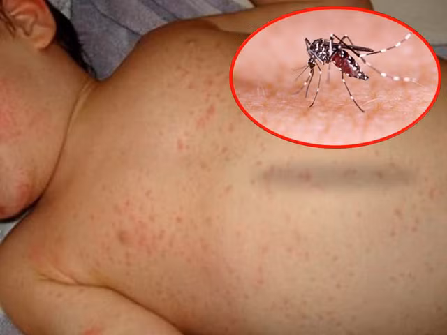 Đã có 6 người tử vong do sốt xuất huyết Da co 6 nguoi tu vong do sot xuat huyet