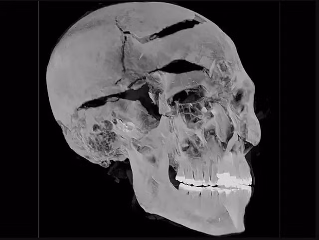 Phát hiện bất ngờ về cái chết của pharaoh Ai Cập - Hình 2 Phat hien bat ngo ve cai chet cua pharaoh Ai Cap-Hinh-2