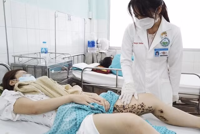 Chi 8 triệu trị rạn da tại spa, cô gái thủng 2 bên đùi như tổ ong Chi 8 trieu tri ran da tai spa, co gai thung 2 ben dui nhu to ong
