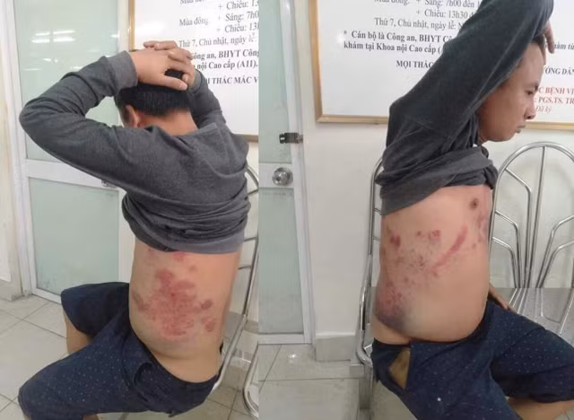 Tài xế bị đánh gãy xương sườn nghi phản đối trạm BOT: Vietracimex 8 nói gì? Tai xe bi danh gay xuong suon nghi phan doi tram BOT: Vietracimex 8 noi gi?