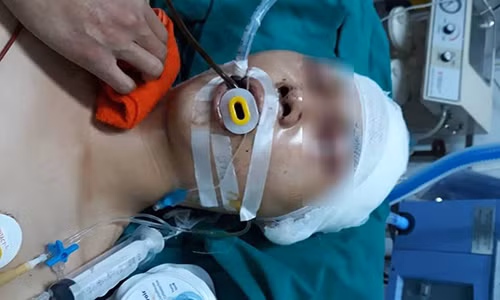 Hà Nội: Nam sinh bị đánh trọng thương ngay cửa nhà Ha Noi: Nam sinh bi danh trong thuong ngay cua nha