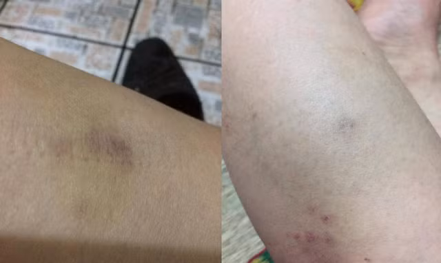 Đòi ly hôn vì bị chồng đánh đến 6 lần nhập viện cấp cứu - Hình 2 Doi ly hon vi bi chong danh den 6 lan nhap vien cap cuu-Hinh-2