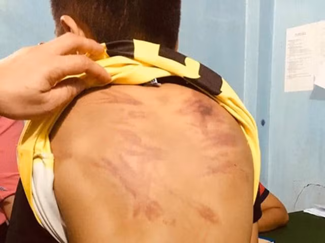 Khởi tố người cha bạo hành con gái 6 tuổi nhiều lần Khoi to nguoi cha bao hanh con gai 6 tuoi nhieu lan