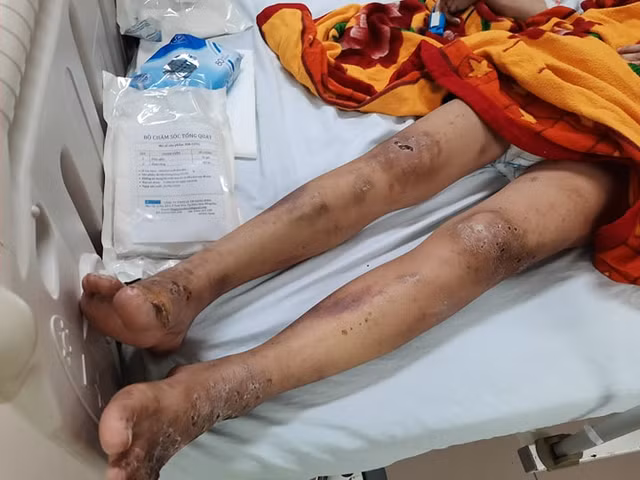 Tiếp viên bị chủ quán chích điện, ép kích dục đã xuất viện - Hình 3 Tiep vien bi chu quan chich dien, ep kich duc da xuat vien-Hinh-3
