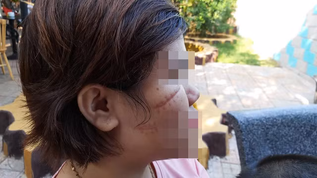 Lý do nhóm côn đồ rạch mặt dã man nữ công nhân - Hình 2 Ly do nhom con do rach mat da man nu cong nhan-Hinh-2