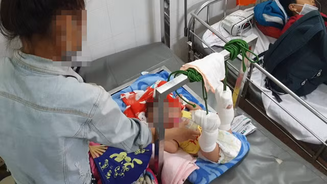 Bắt giam người cha bạo hành con ruột 4 tháng tuổi xuất huyết não, gãy xương ở Sài Gòn Bat giam nguoi cha bao hanh con ruot 4 thang tuoi xuat huyet nao, gay xuong o Sai Gon